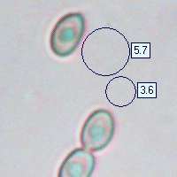 Spores of Agaricus moelleri, Inky Mushroom