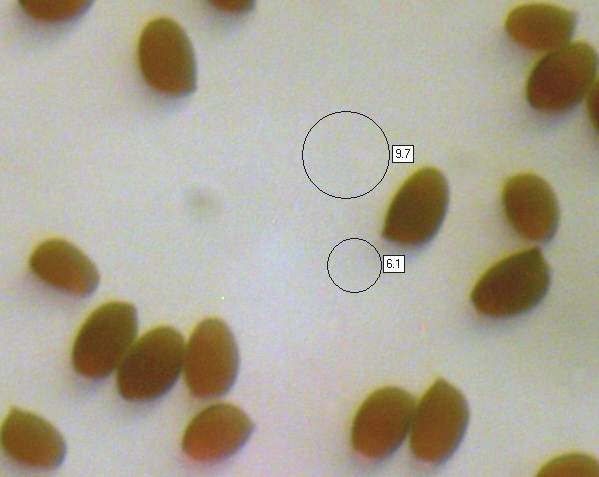 Spores of Chlorophyllum rhacodes