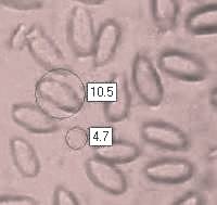 Spores of Crucibulum laeve, Common Bird's-nest Fungus