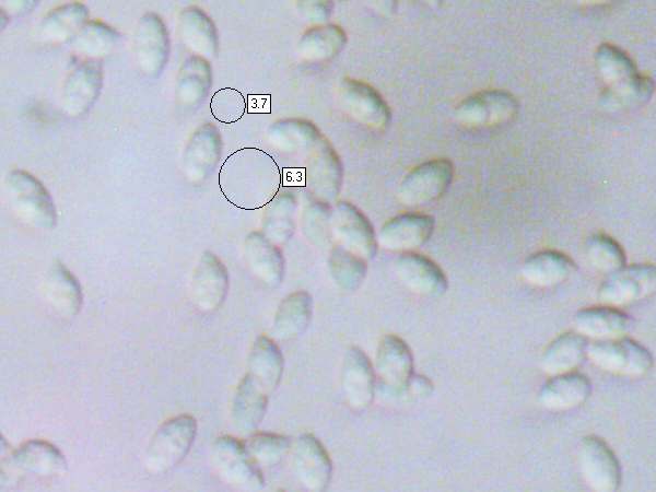 Spores of Cystoderma jasonis
