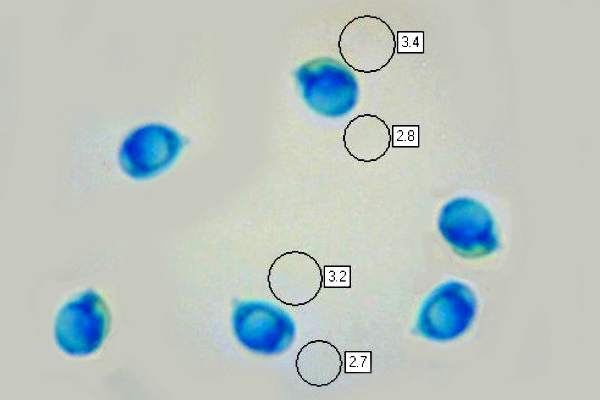 Spores of Cystoderma simulatum