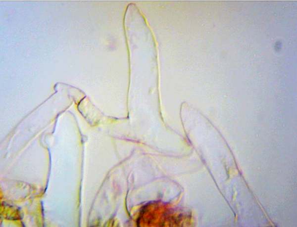 Cap structure of Cystolepiota pulverulenta