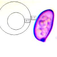 Spores of Leucocoprinus badhamii