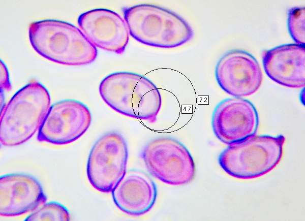 Spores of Leucocoprinus badhamii
