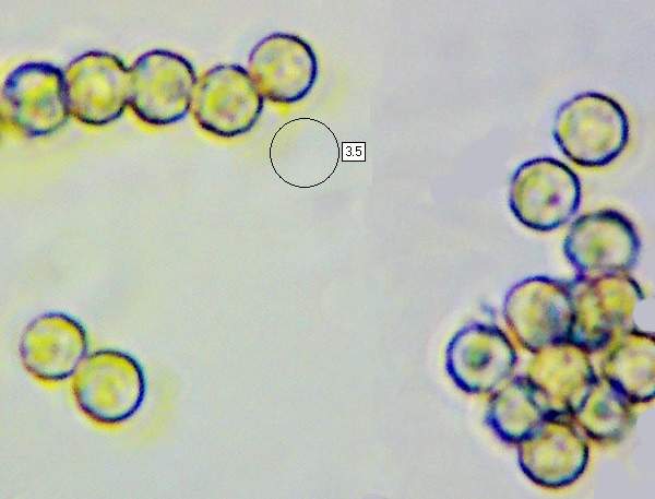 Spores of Lycoperdon perlatum
