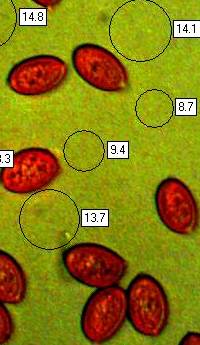 Spores of Macrolepiota excoriata