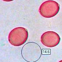 Spores of Macrolepiota procera