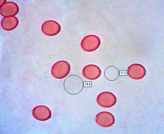Spores of Macrolepiota-procera