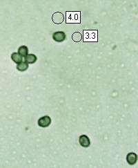 Spores of Albatrellus subrubescens