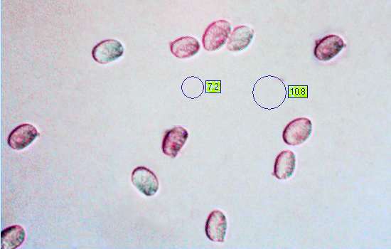 Spores of Amanita caesarea