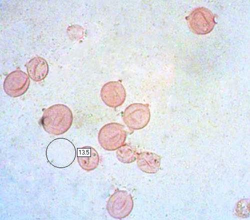 Spores of Amanita ceciliae