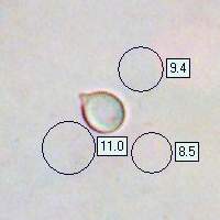 Spores of Amanita citrina