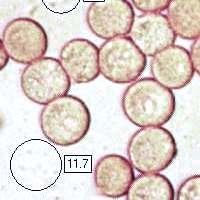 Spores of Amanita crocea, the Orange Grisette