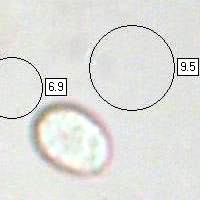 Spores, Amanita franchetii