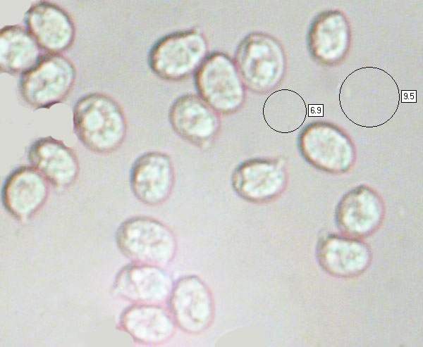 Spores of Amanita franchetii