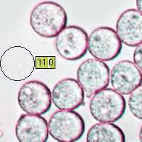 Spores of Amanita fulva