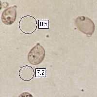 Spores of Amanita muscaria, the Fly Agaric