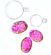 Spores of Amanita ovoidea