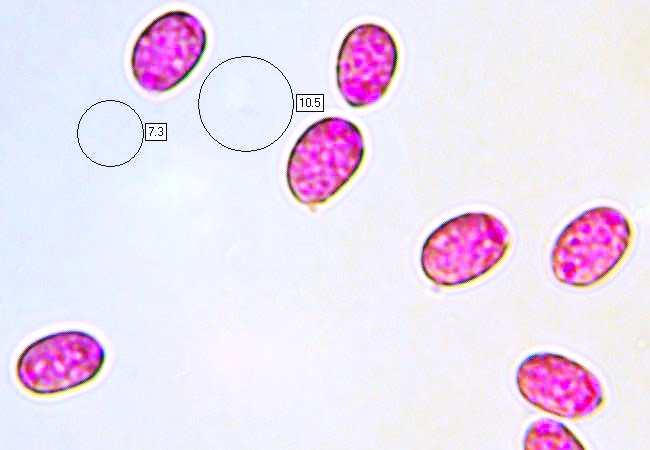 Spores of Amanita ovoidea