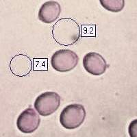 Spores of Amanita porphyria