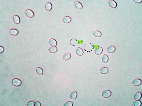 Spores of Amanita porphyria