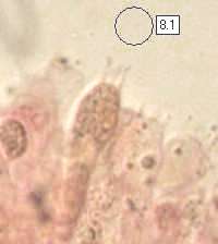 Basidia of Amanita rubescens