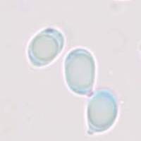 Spores of Amanita rubescens