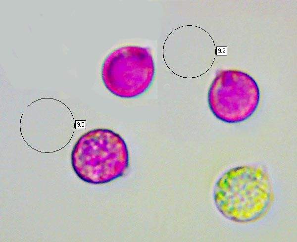Spores of Amanita vaginata