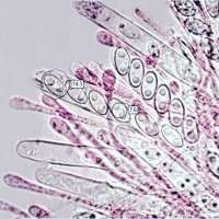 Asci and spores of Aleuria aurantia