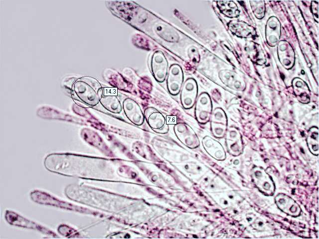 Asci of Aleuria aurantia