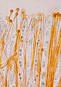 Paraphyses of Aleuria aurantia
