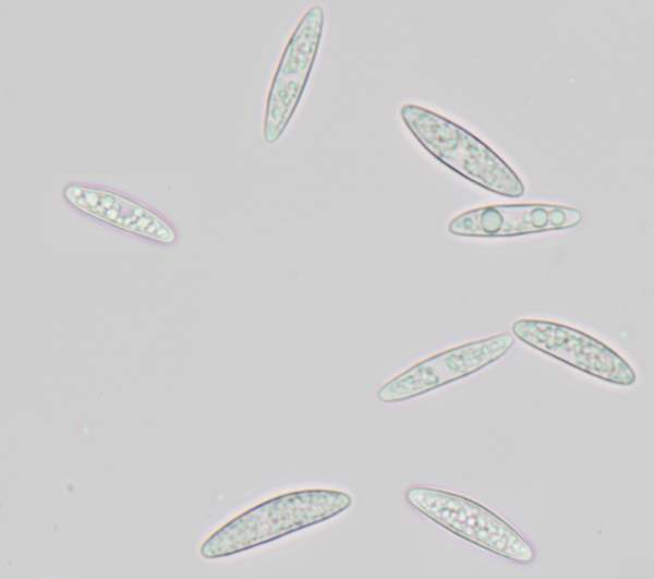 Ascospores of Ascocoryne cylichnium