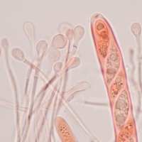 Ascus and paraphyses,of Ascocoryne sarcoides