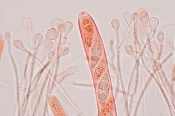 Asci and paraphyses of Ascocoryne sarcoides