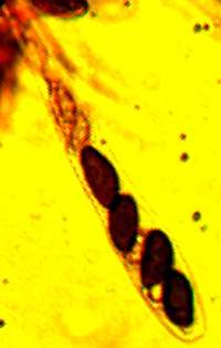 Ascus of Bulgaria inquinans