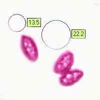 Brown spores of Bulgaria inquinans