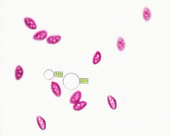 Spores of Bulgaria inquinans