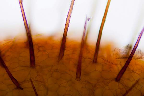 Hairs of Cheilymenia fimicola