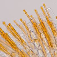 Asci and spores of <em>Cheilymenia stercorea</em>