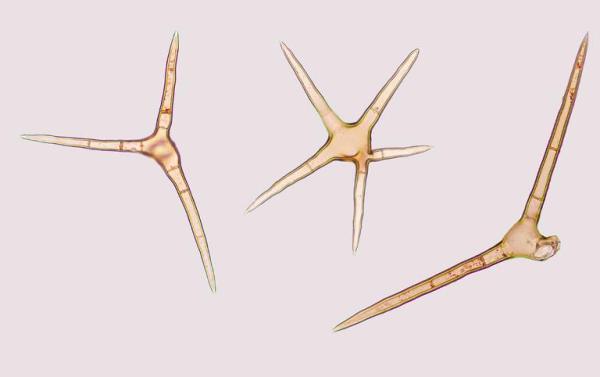 Hairs of Cheilymenia stercorea