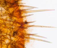 Marginal hairs of <em>Cheilymenia stercorea</em>