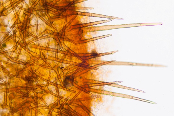 Hairs of Cheilymenia stercorea