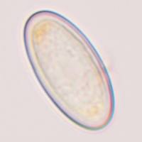 Spore of Cheilymenia stercorea