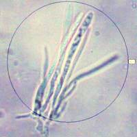 Asci and paraphyses of <em>Chlorociboria aeruginascens</em>