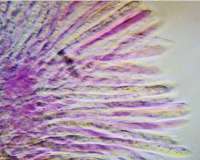 Asci and paraphyses of <em>Chlorociboria aeruginosa</em>