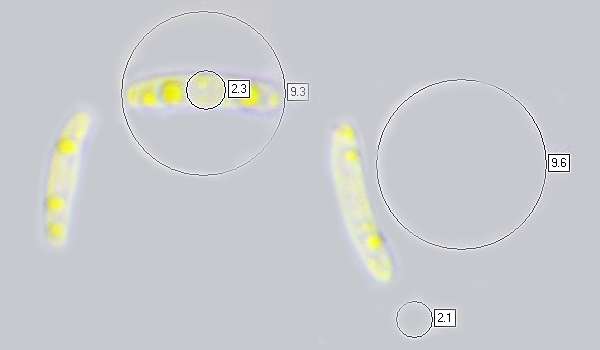 Asci of Chlorociboria aeruginosa
