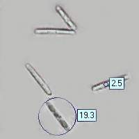 Part spores of Cordyceps capitata