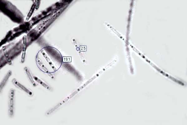 Spores of Cordyceps capitata