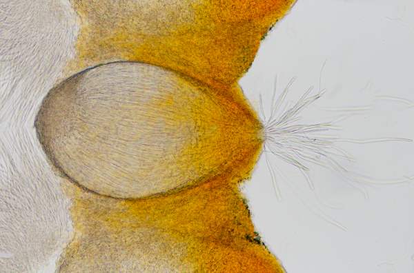 Perithecia of Cordyceps militaris