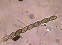 Ascus of <em>Daldinia concentrica</em>